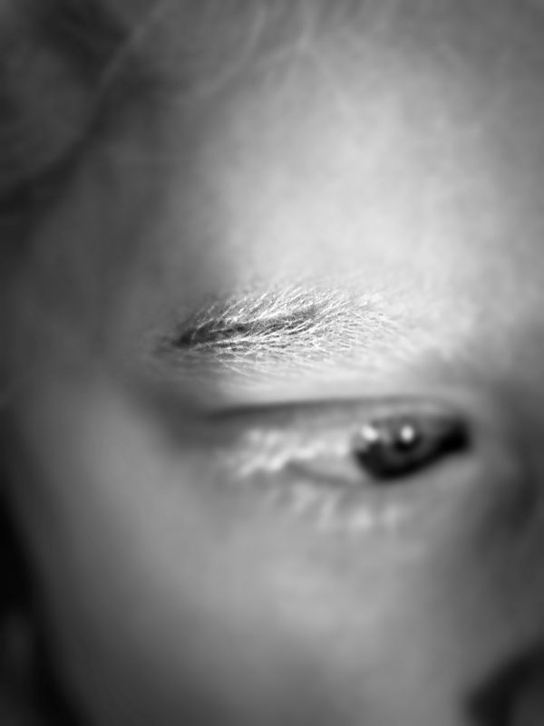 © Niccolò Zorza - Image from the Scars - Behind every scar there is a story photography project