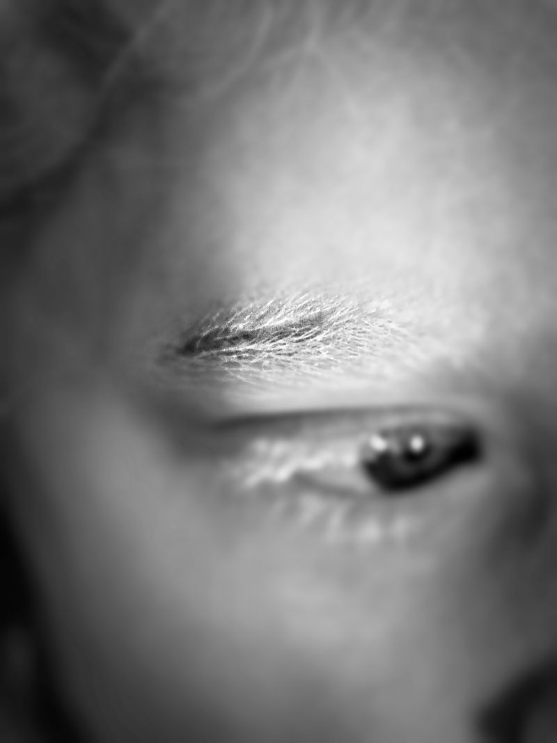 © Niccolò Zorza - Image from the Scars - Behind every scar there is a story photography project