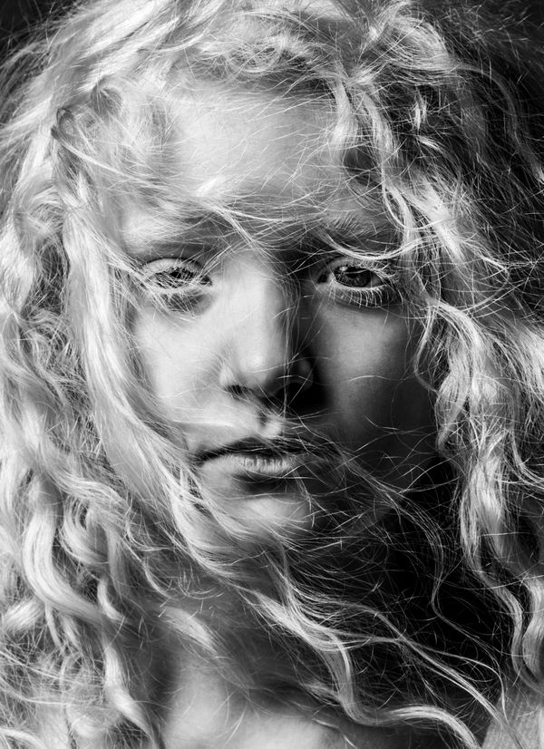 © Niccolò Zorza - Image from the Scars - Behind every scar there is a story photography project