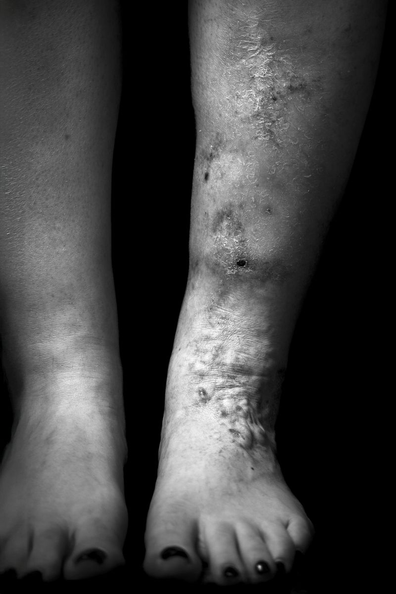 © Niccolò Zorza - Image from the Scars - Behind every scar there is a story photography project