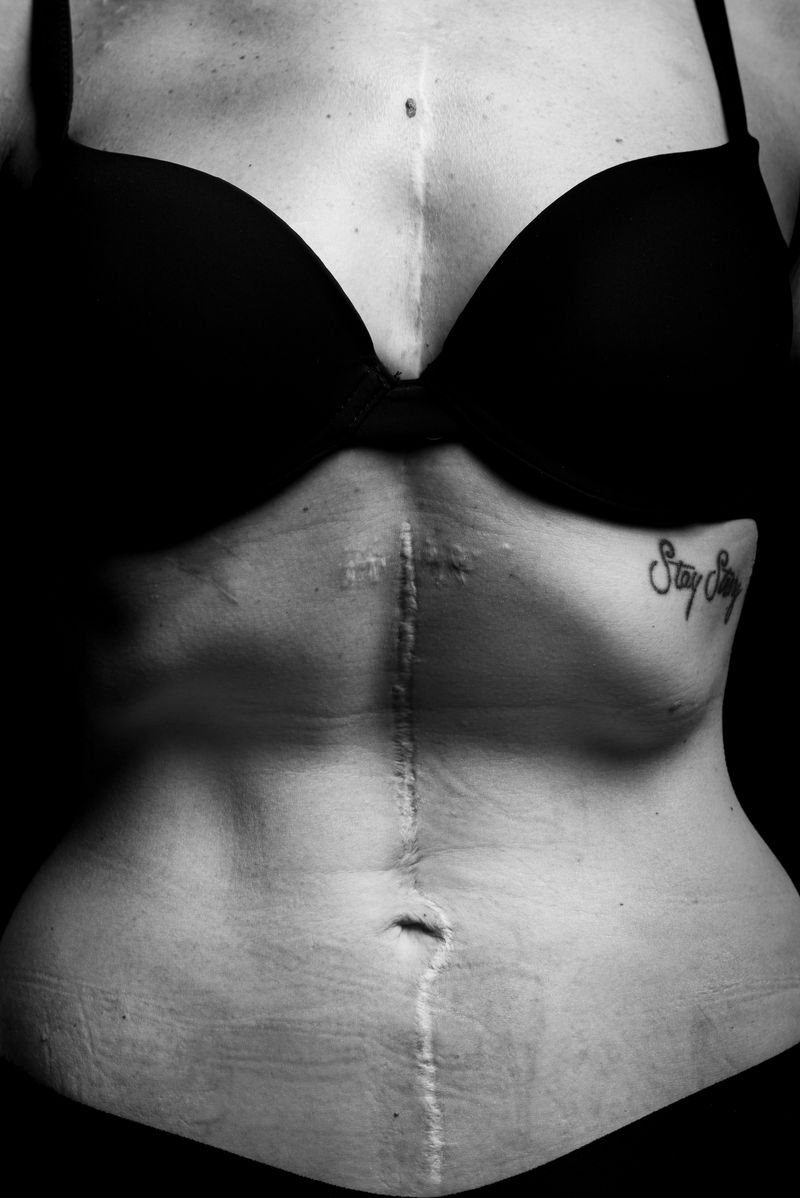 © Niccolò Zorza - Image from the Scars - Behind every scar there is a story photography project