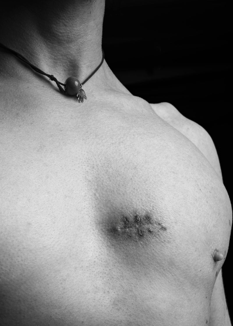 © Niccolò Zorza - Image from the Scars - Behind every scar there is a story photography project