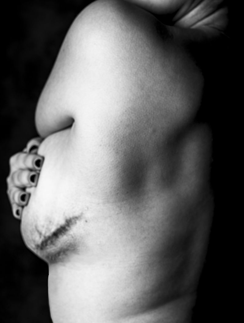 © Niccolò Zorza - Image from the Scars - Behind every scar there is a story photography project