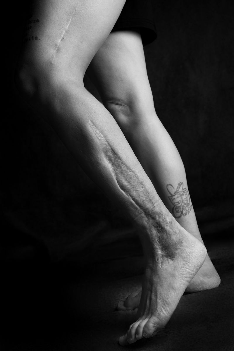 © Niccolò Zorza - Image from the Scars - Behind every scar there is a story photography project