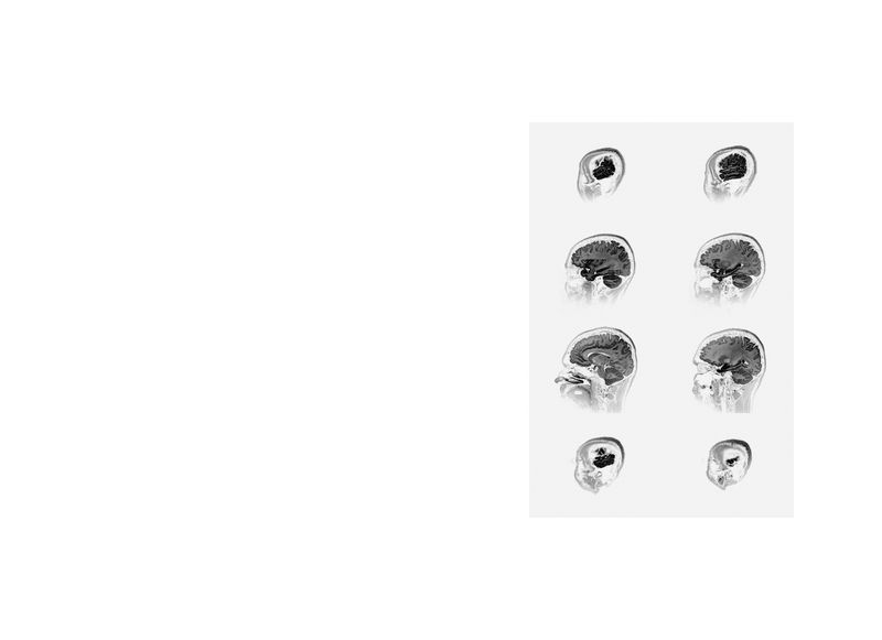 Image from a project on PhMuseum