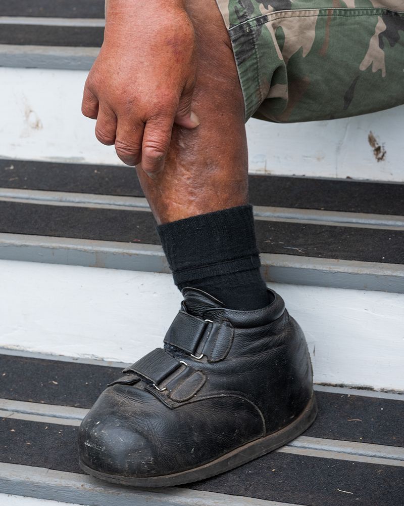 © Shannon Benine - Uncle Boogie, Kalaupapa Bookstore Steps, 2016, 40 x 32 inches, archival inkjet print