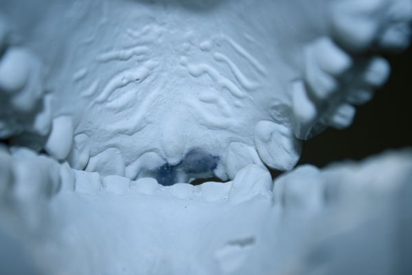 © lou muñoz - Flat Teeth, 2025, Inkjet Print.