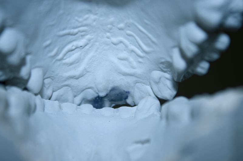 © lou muñoz - Flat Teeth, 2025, Inkjet Print.