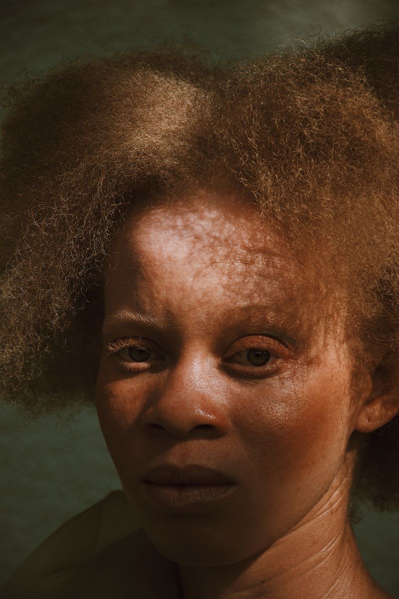 © Keren Lasme - Image from the Beneath our skin lies the sun photography project