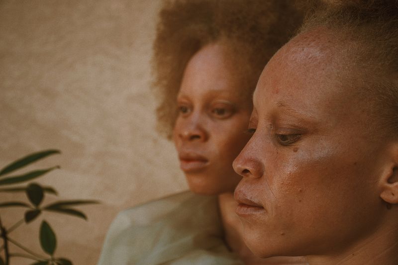 © Keren Lasme - Image from the Beneath our skin lies the sun photography project