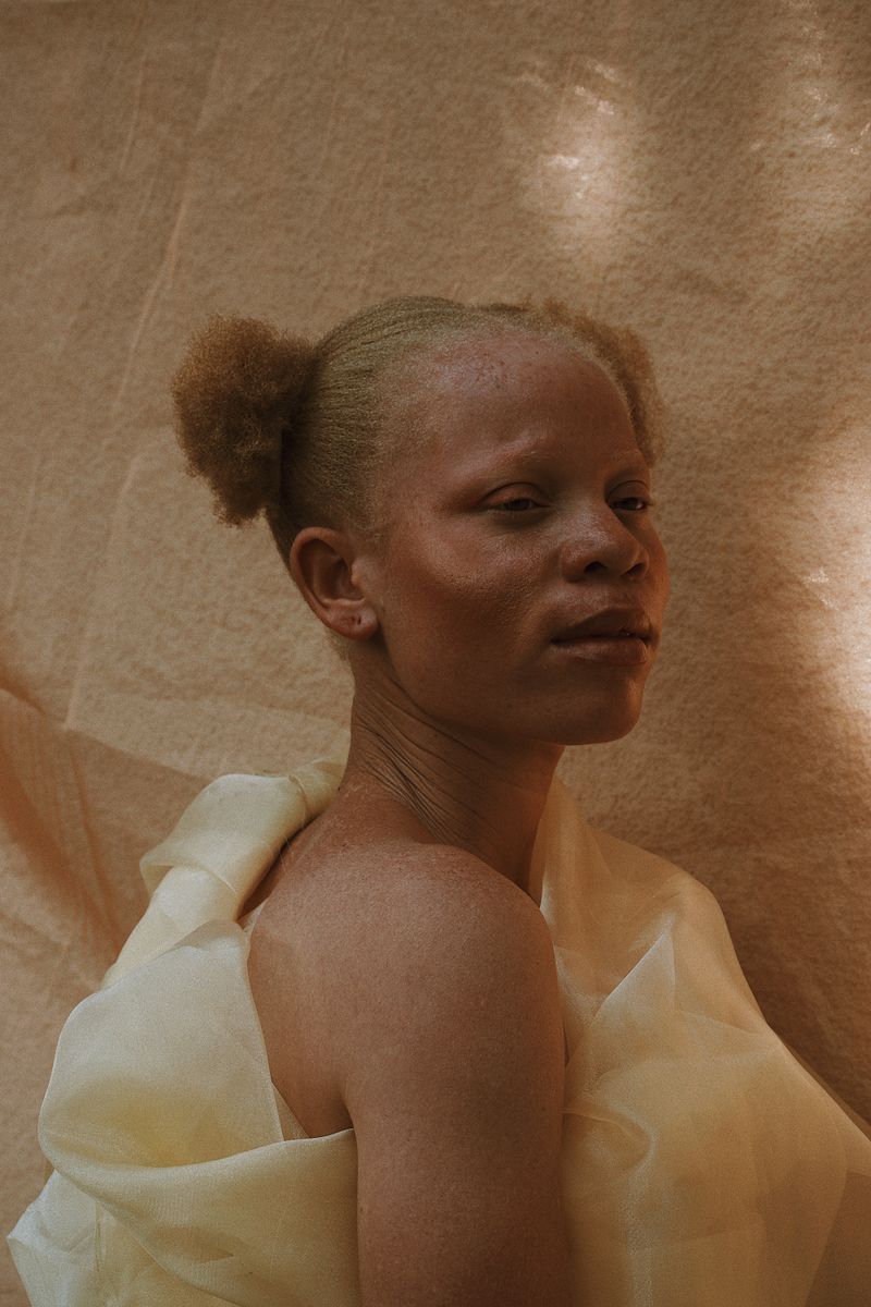 © Keren Lasme - Image from the Beneath our skin lies the sun photography project