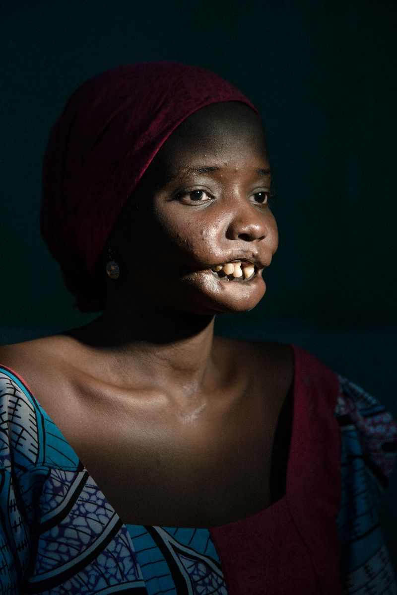 © Claire Jeantet - Image from the Faces of Noma photography project