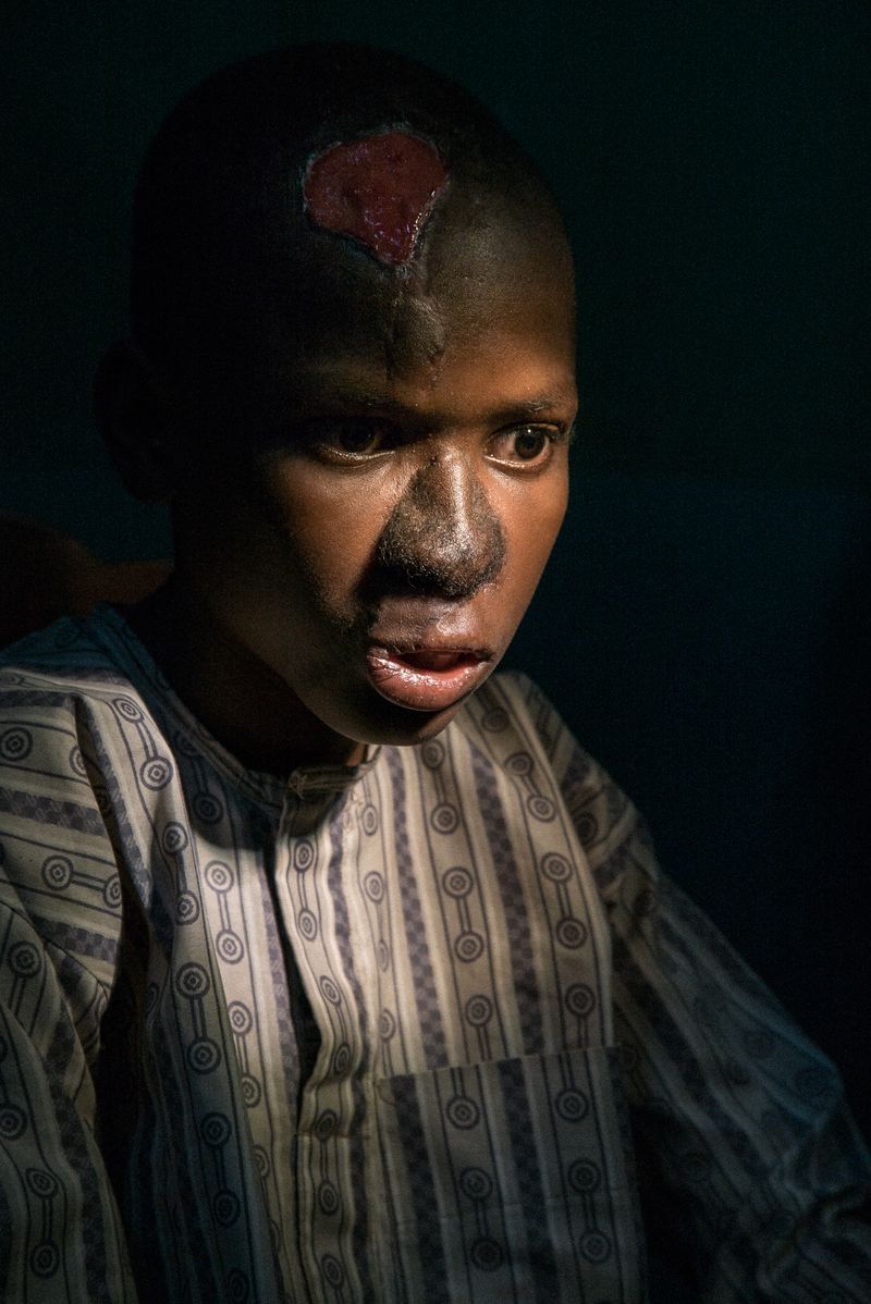 © Claire Jeantet - Image from the Faces of Noma photography project