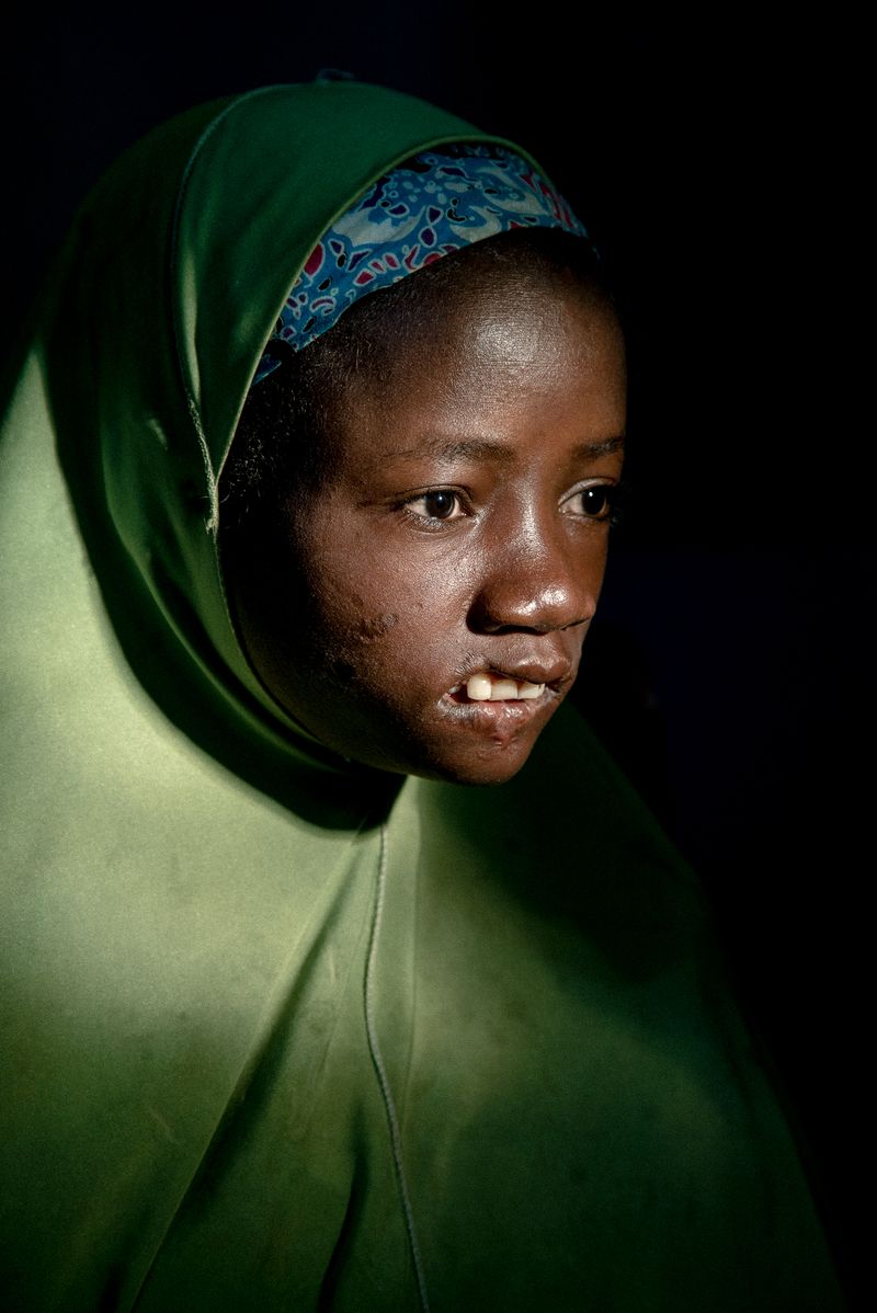 © Claire Jeantet - Image from the Faces of Noma photography project