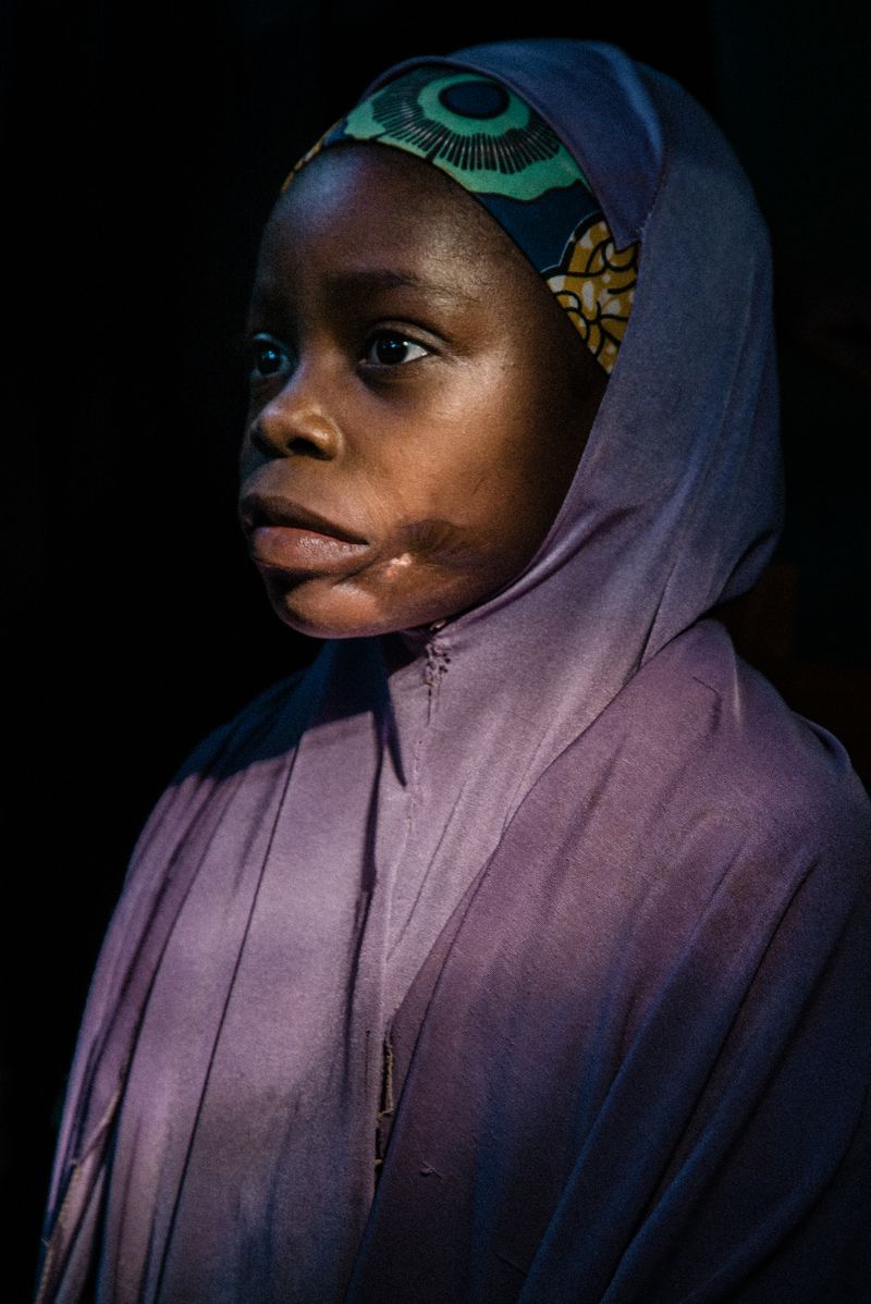 © Claire Jeantet - Image from the Faces of Noma photography project