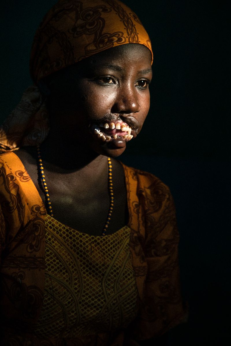 © Claire Jeantet - Image from the Faces of Noma photography project