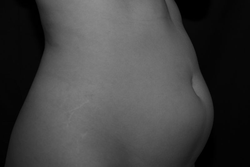 © Rachele Cipollini - Image from the Fragments of a body photography project