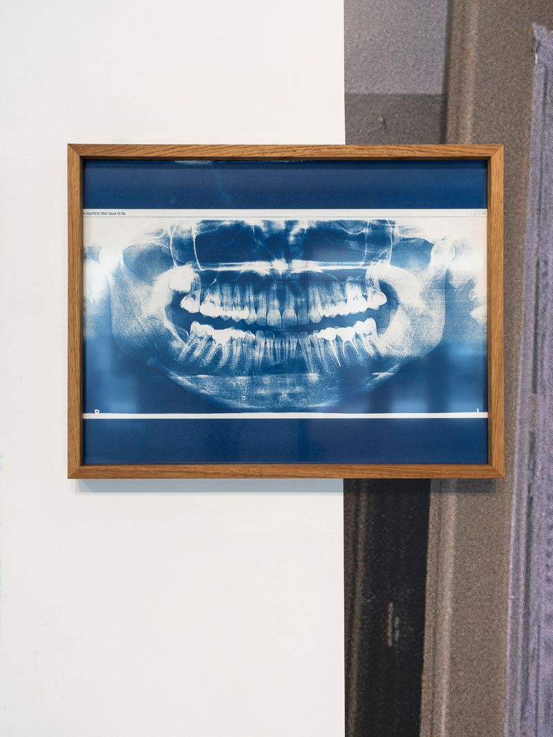 © Lucija Rosc - Orthopantomogram (OPG),  2024