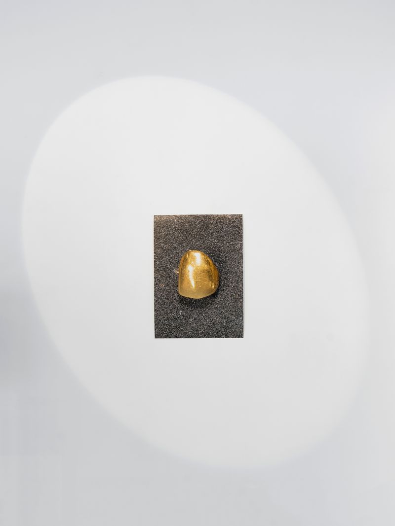 © Lucija Rosc - Mica's golden dental crown, 2023