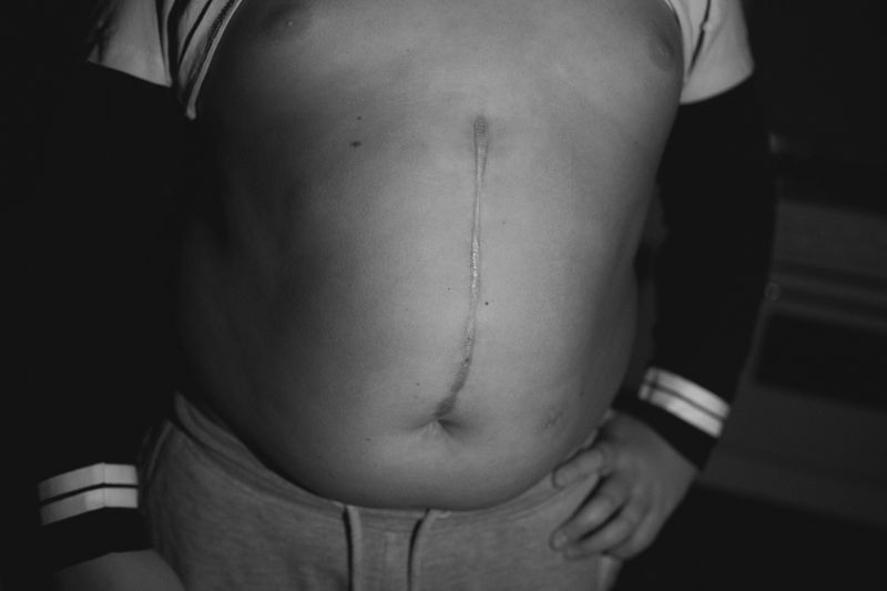 © Matteo Trevisan - Image from the Over the riverbank photography project