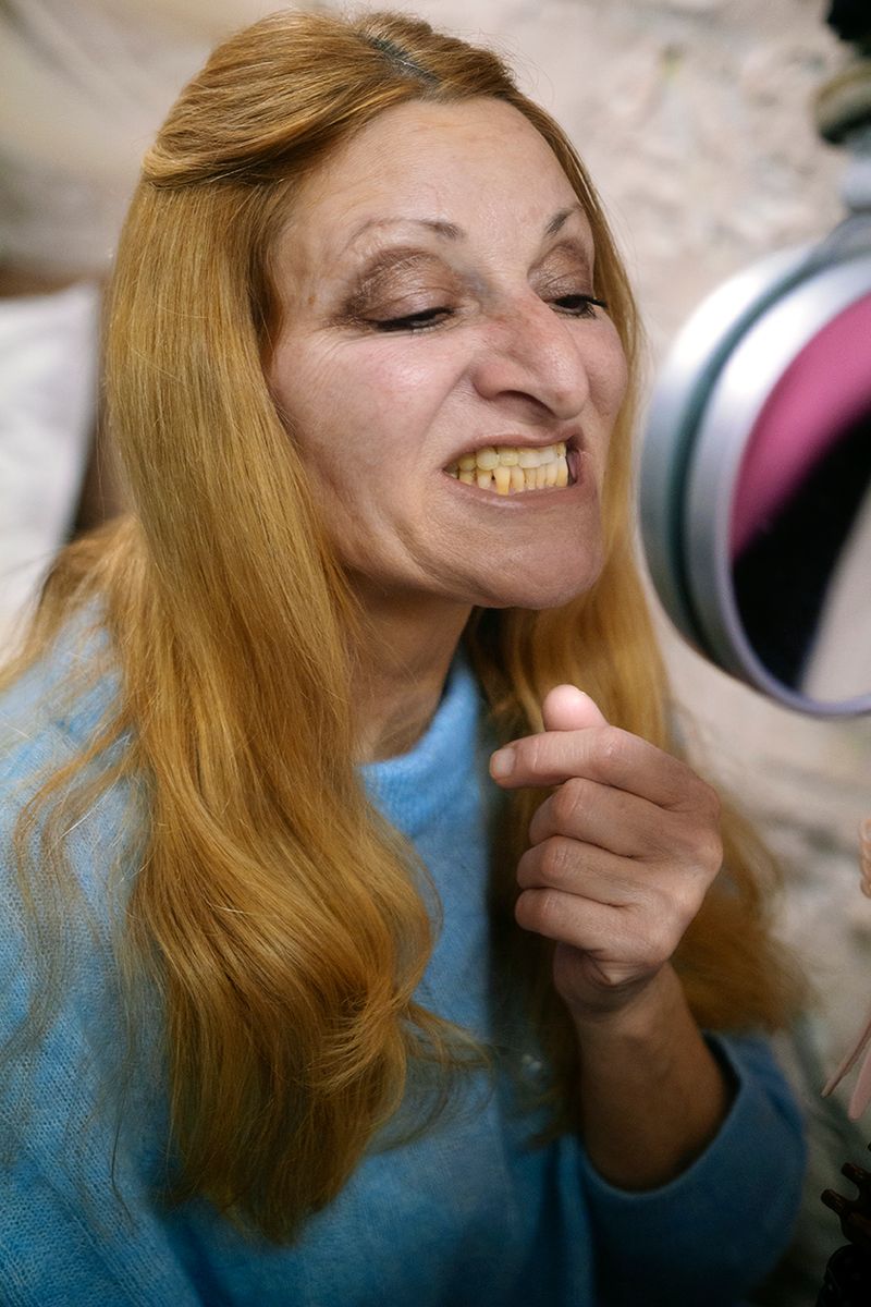 © Chelsea Muscat - Yellow Teeth Pinch