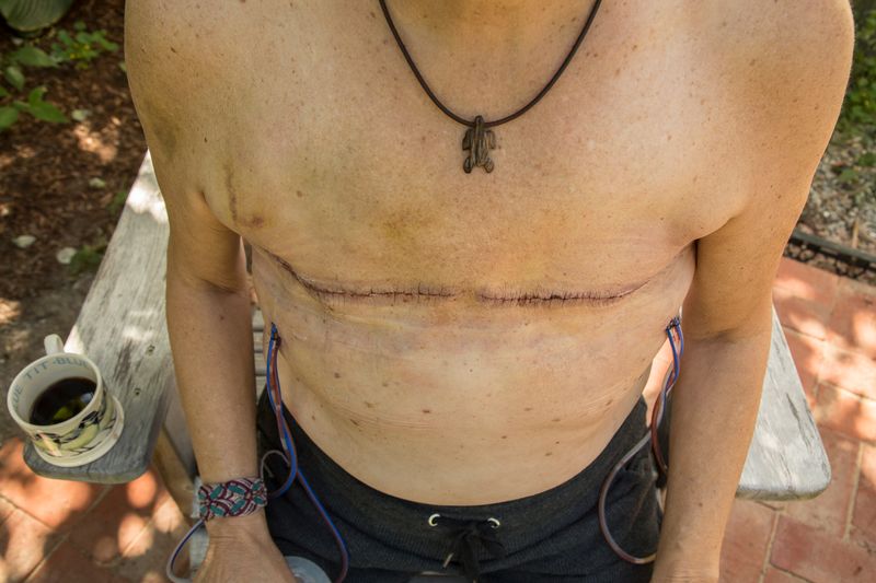 © Gioia Kuss - Image from the The Heart of the Matter—A Woman’s Front. photography project