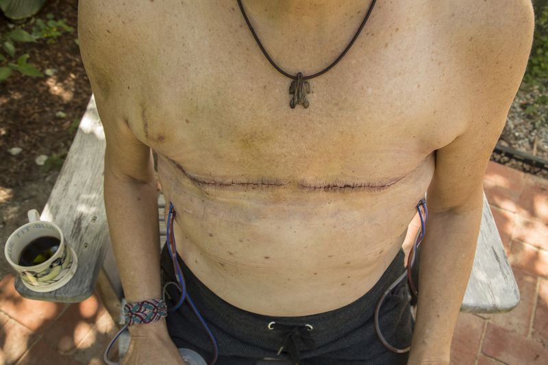 © Gioia Kuss - Image from the The Heart of the Matter—A Woman’s Front. photography project