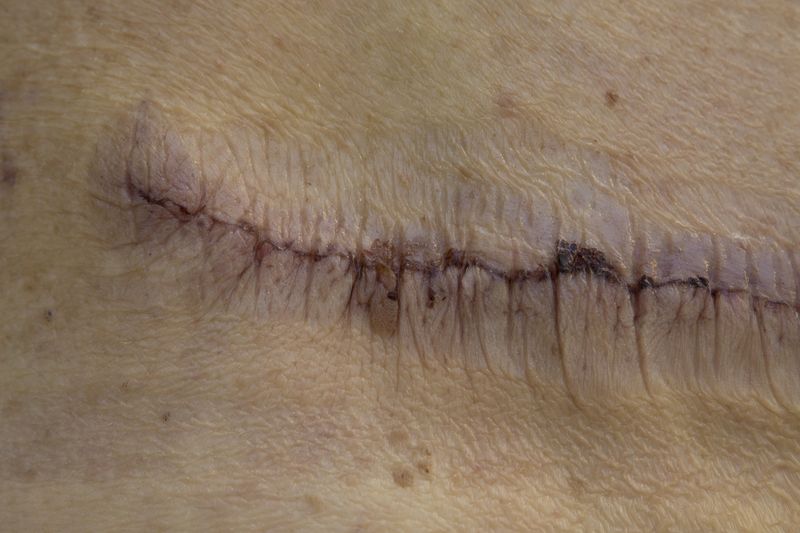 © Gioia Kuss - Image from the The Heart of the Matter—A Woman’s Front. photography project