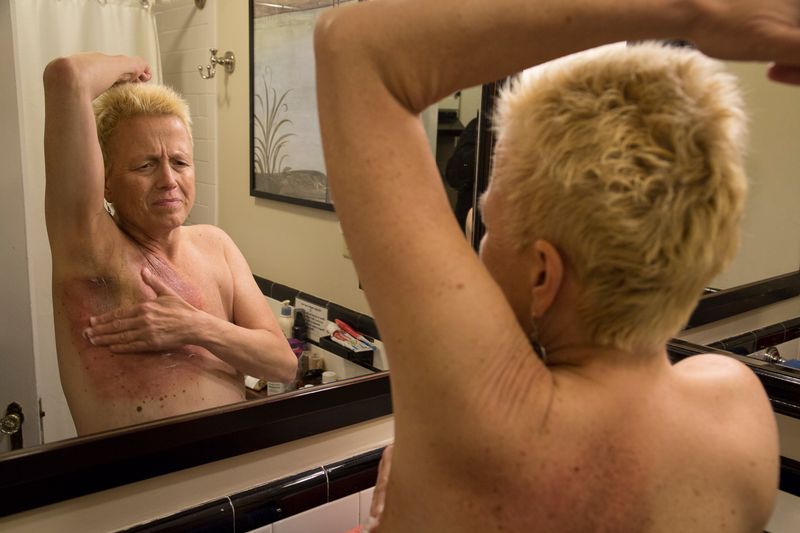 © Gioia Kuss - Image from the More Than Skin Deep photography project