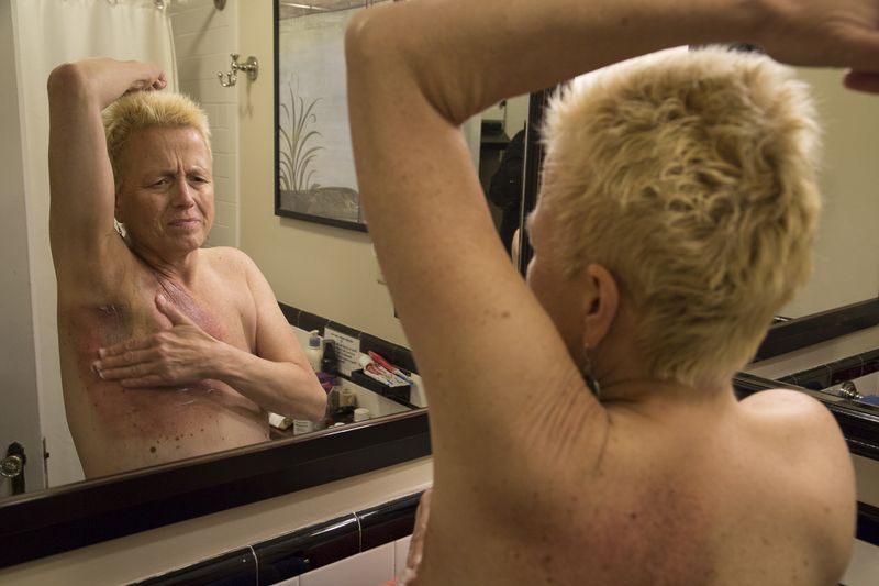 © Gioia Kuss - Image from the More Than Skin Deep photography project