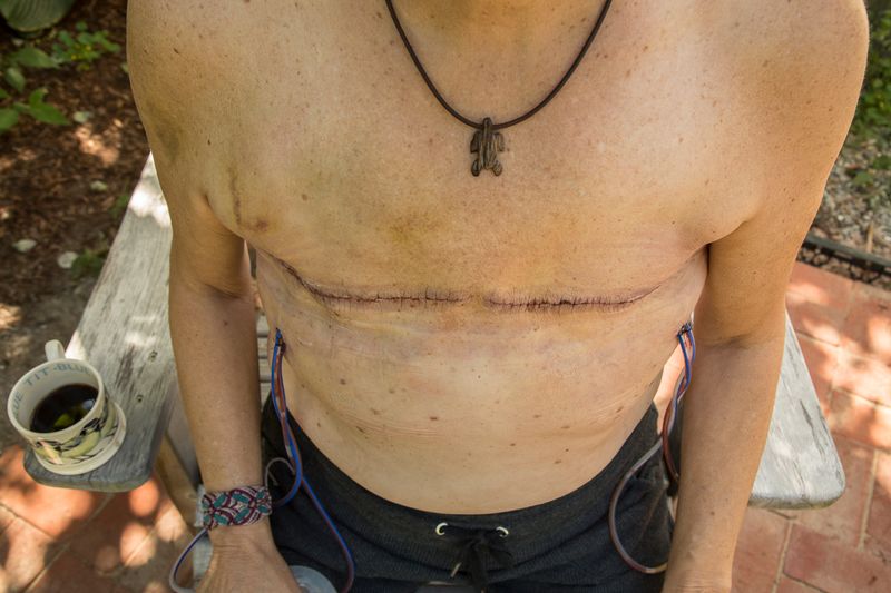 © Gioia Kuss - Image from the More Than Skin Deep photography project