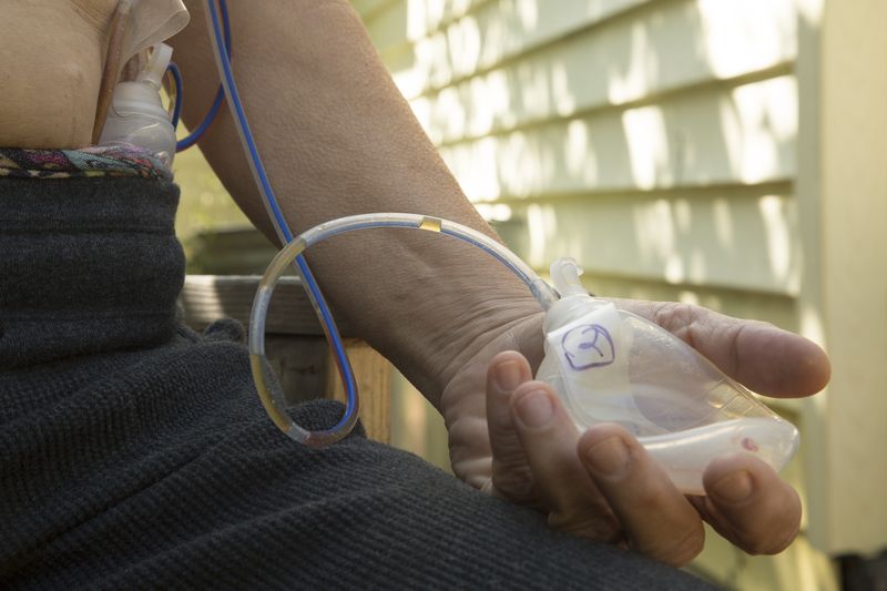 © Gioia Kuss - Image from the More Than Skin Deep photography project