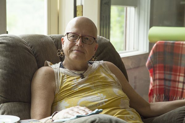 © Gioia Kuss - Image from the More Than Skin Deep photography project