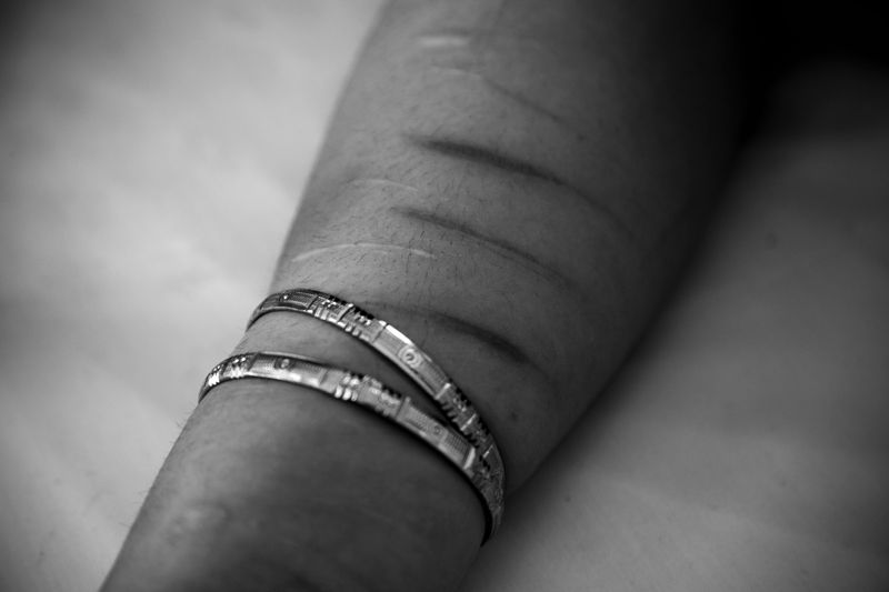 © Azadeh Besharati - At various points, Shima and, more frequently, Shiva attempted suicide using a razor blade.