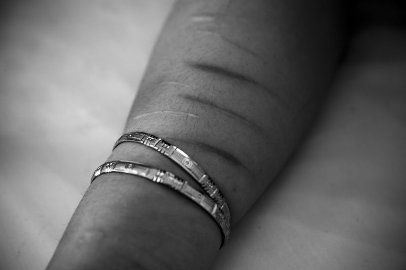 © Azadeh Besharati - At various points, Shima and, more frequently, Shiva attempted suicide using a razor blade.