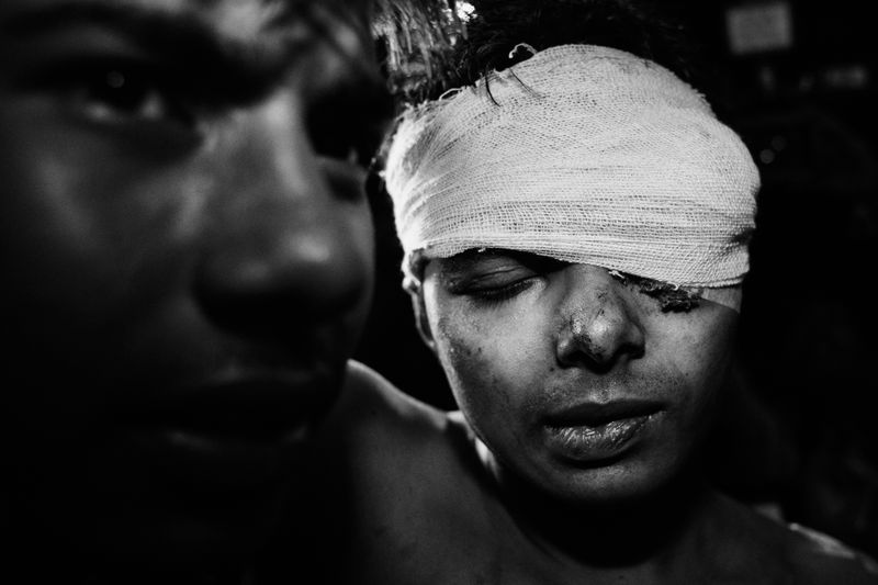 © Suvra Kanti Das - Image from the Bigotry​ photography project