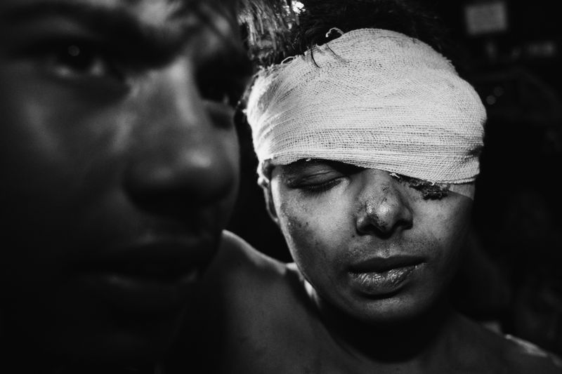 © Suvra Kanti Das - Image from the Bigotry​ photography project