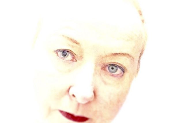 © Karen Borger - Anisocoria