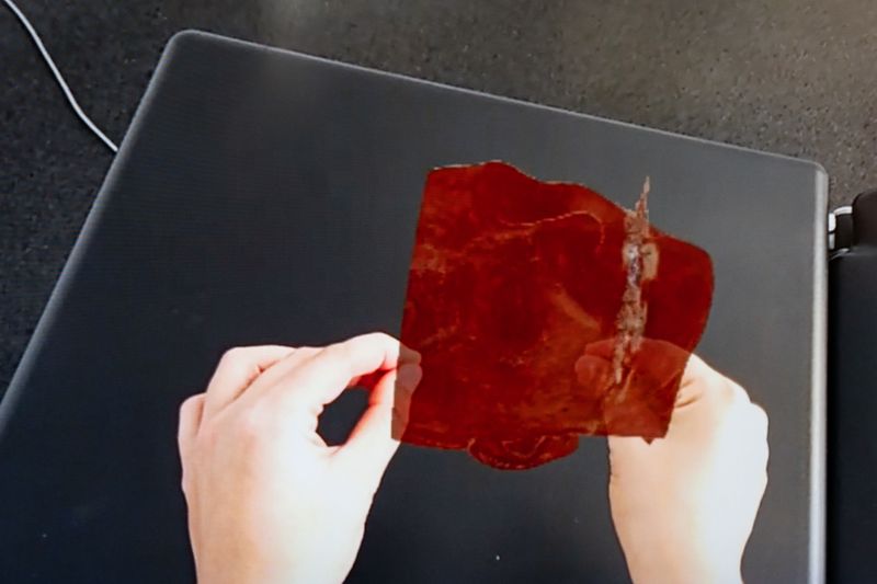 © Aristidis Schnelzer - View through Hololens.