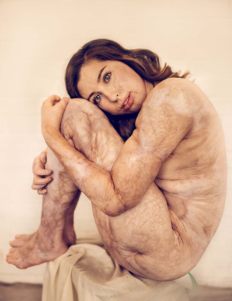 © Sujata Setia - Image from the Change the conversation photography project