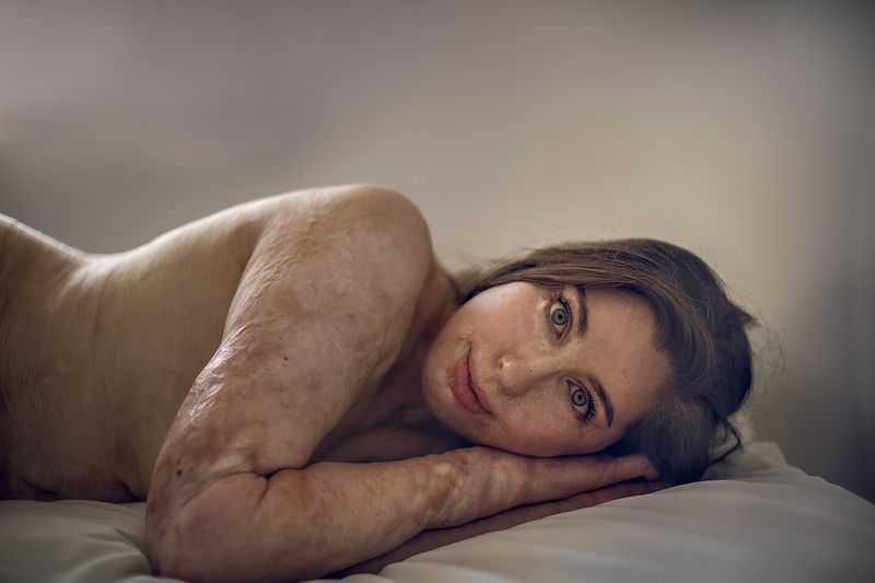 © Sujata Setia - Image from the Change the conversation photography project