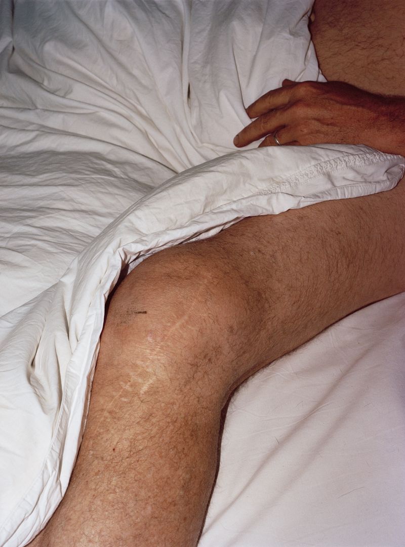 © CJ Chandler - Image from the the twist of a knee photography project