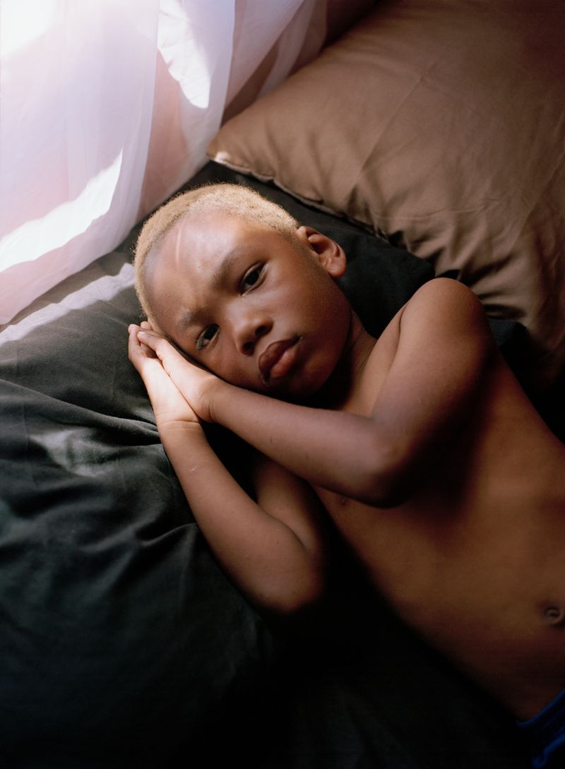 © CJ Chandler - Image from the the twist of a knee photography project