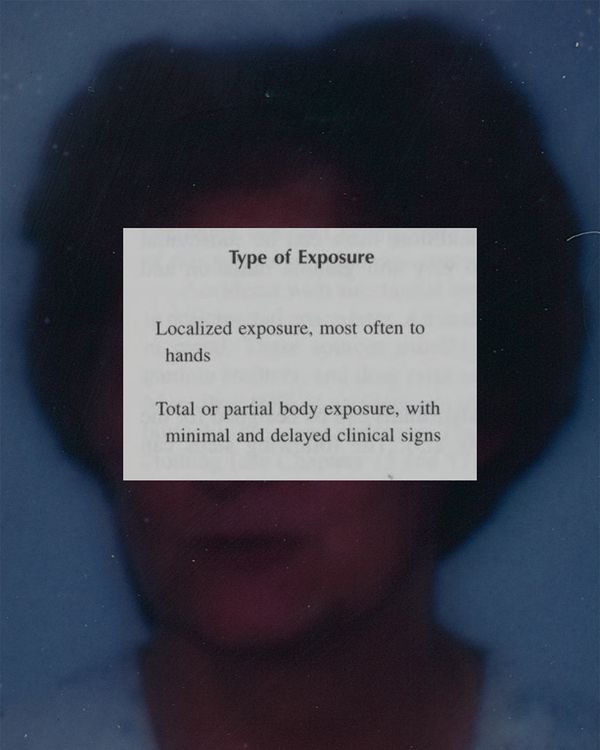 © Edward Nurton - Image from the THE ELEPHANT'S FOOT photography project