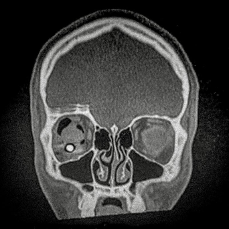 © Cristóbal Olivares - X ray showing the embedded pellet of an injured man during Santiago protests.