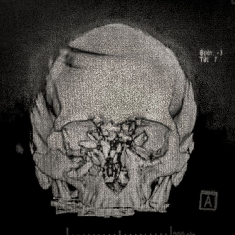 © Cristóbal Olivares - Image from the They are marking us photography project