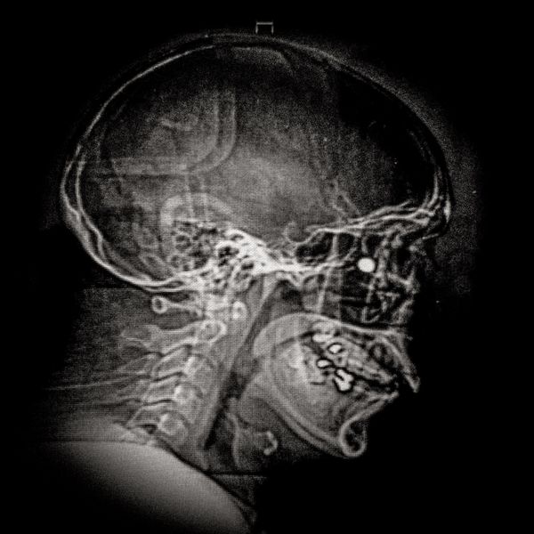 © Cristóbal Olivares - Image from the They are marking us photography project