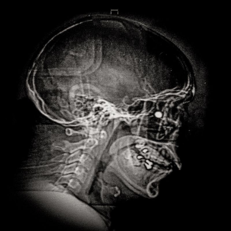 © Cristóbal Olivares - Image from the They are marking us photography project