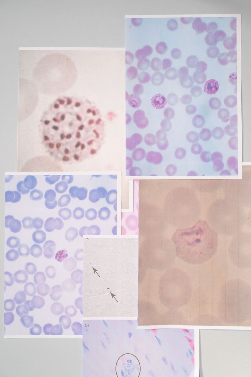 © Sofia Noce - Study on Plasmodium