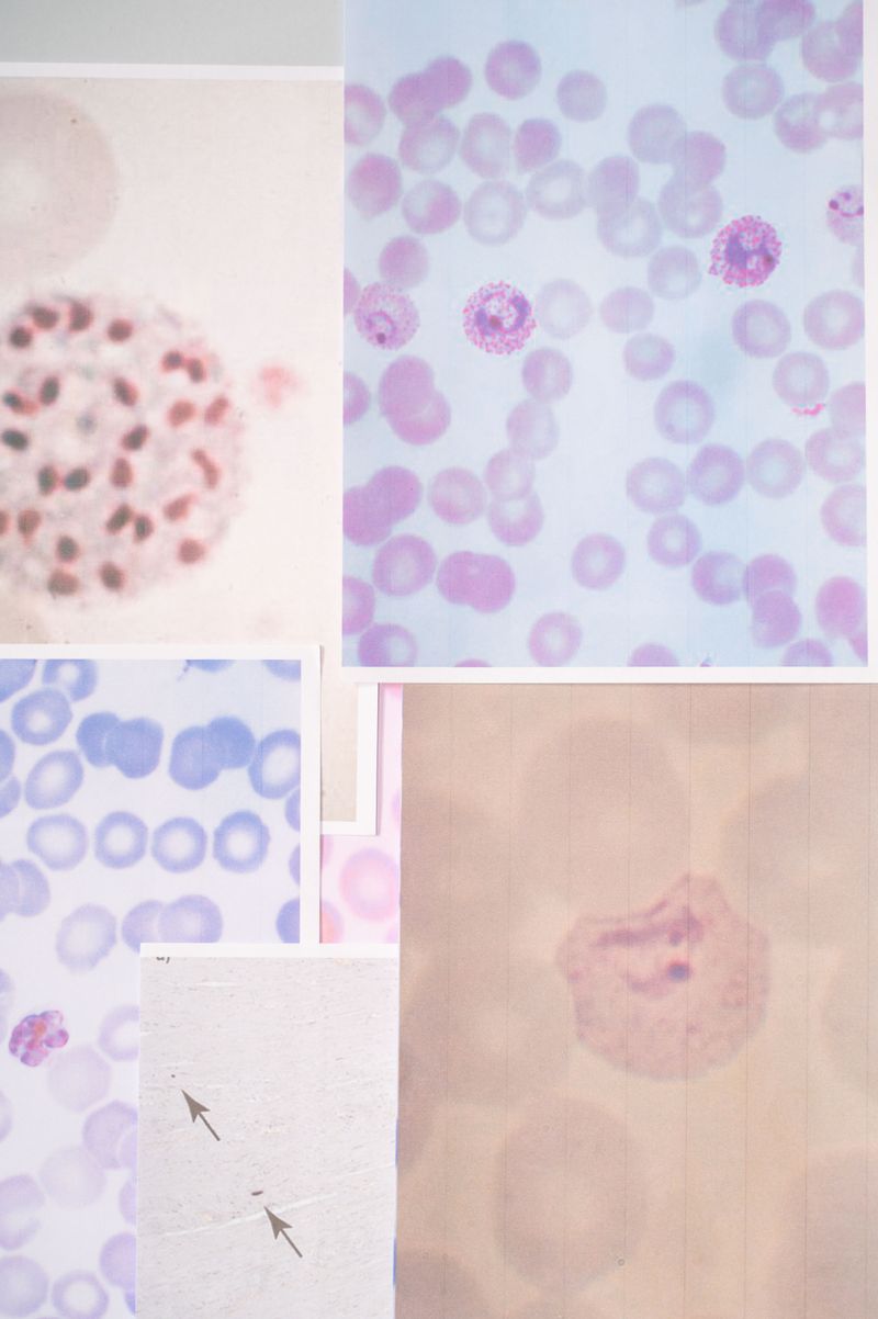 © Sofia Noce - Study on Plasmodium